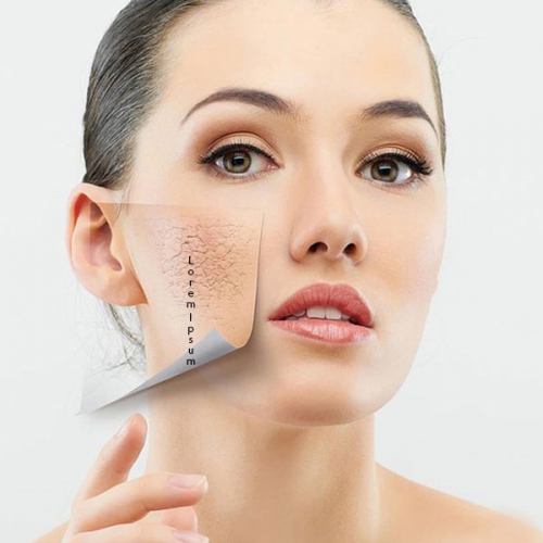 Cách Chăm Sóc Da Khô Mùa Đông Bằng 6 Lời Khuyên Hàng Đầu