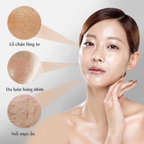 Các Bước Chăm Sóc Da Dầu Mụn Chuẩn Các Cô Nàng