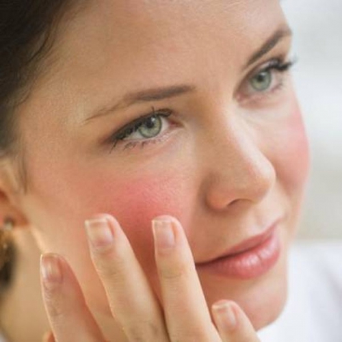 Chăm Sóc Da Nhạy Cảm Bị Mụn Để Tránh Bị Kích Ứng Da