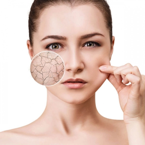 Các Bước Skincare Cho Da Khô Giúp Cải Thiện Tình Trạng Khô Da
