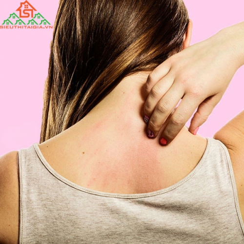Tại Sao Lại Bị Dị Ứng? Chữa Trị Thế Nào?
