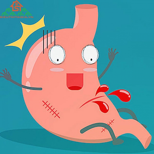 Những Điều Chưa Biết Về Xuất Huyết Tiêu Hóa 