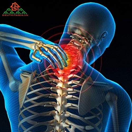 Bệnh Đau Vai Gáy Là Gì Và Trị Thế nào?