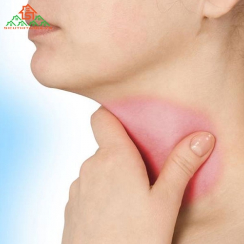 Dấu Hiệu Nhận Biết Bệnh Bướu Cổ Và Cách Điều Trị