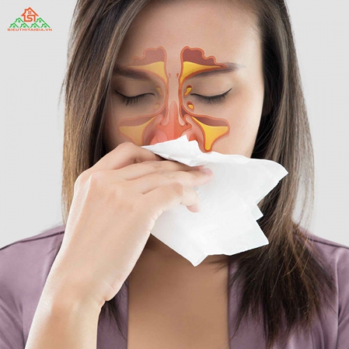 Triệu Chứng Viêm Xoang Và Cách Phòng Tránh Bệnh