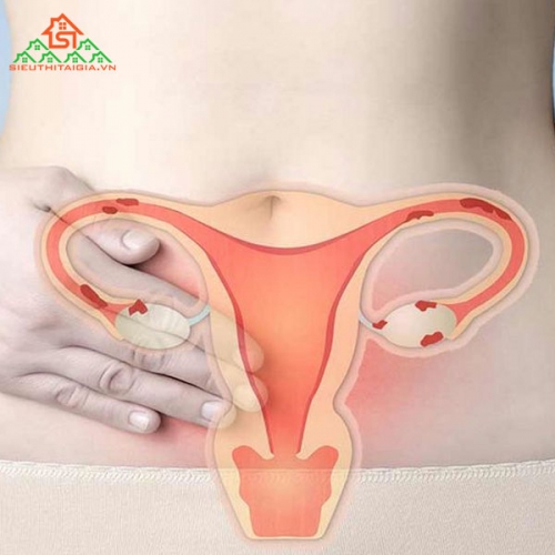 Chích Ngừa Ung Thư Cổ Tử Cung Có Cần Thiết Không?