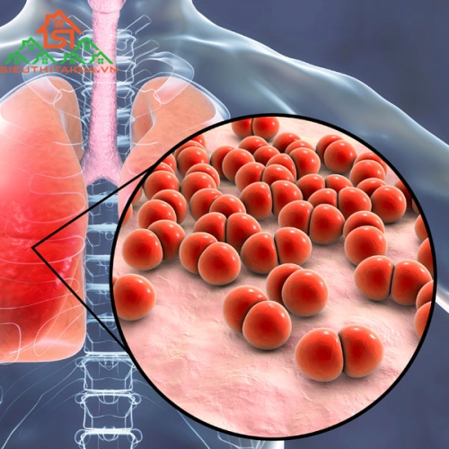 Các Bệnh Nguy Hiểm Do Phế Cầu Khuẩn Gây Ra