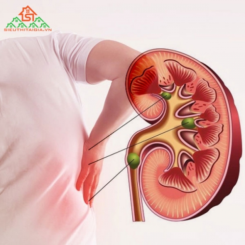 Phát Hiện Ngay Dấu Hiệu Suy Thận Để Chữa Trị Kịp Thời