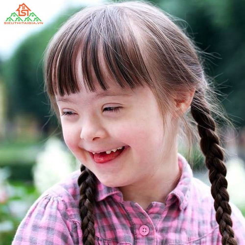 Những Điều Cần Biết Về Hội Chứng Down