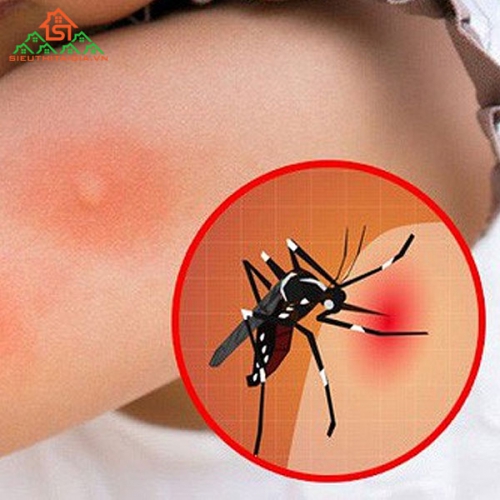 Biểu Hiện Sốt Xuất Huyết Thế Nào và Cách Điều Trị?