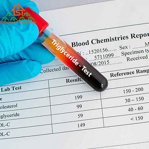 Chỉ Số Triglyceride Là Gì Và Cách Kiểm Soát Ở Mức Phù Hợp