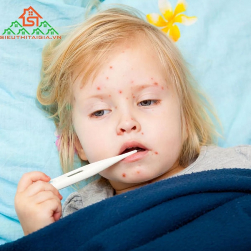 Nhận Biết Triệu Chứng Sốt Siêu Vi
