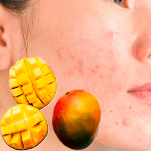 Ăn xoài có nổi mụn không? Cách ăn xoài tốt